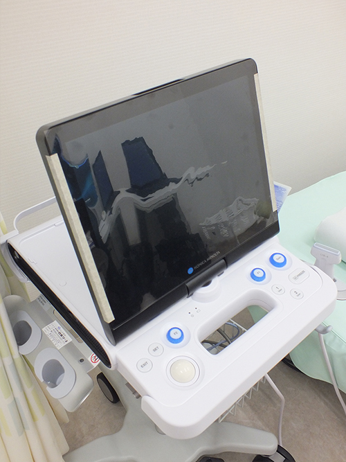 超音波画像診断装置